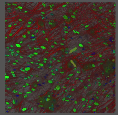 High-content imaging analysis